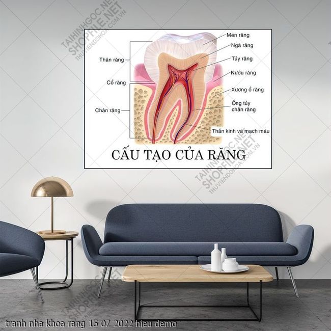 tranh y khoa nha khoa rang 15 07 2022 hieu